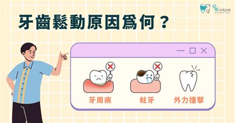 牙齒疏|牙齒鬆動補救方法有哪些？鬆動原因到治療方法一次看。